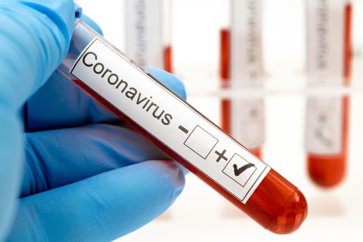 Cifras de Covid-19 en Centroamérica alcanza los 545,088 casos