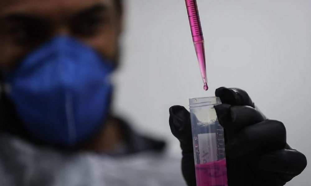 OMS señala que casos de Viruela del Mono en Reino Unido son de la variante menos grave