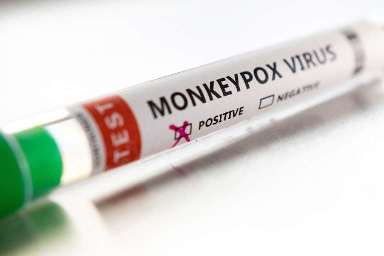 Argentina confirma primer caso de la viruela del mono
