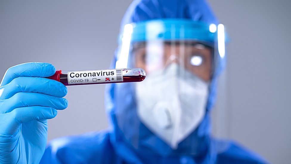 Unidad Médica Nicaragüense asegura que Chinandega, Estelí, Masaya y Managua focos de contagio de Covid-19